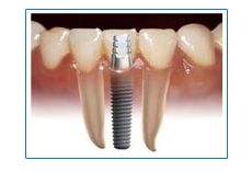 chirurgie plastique tunisie