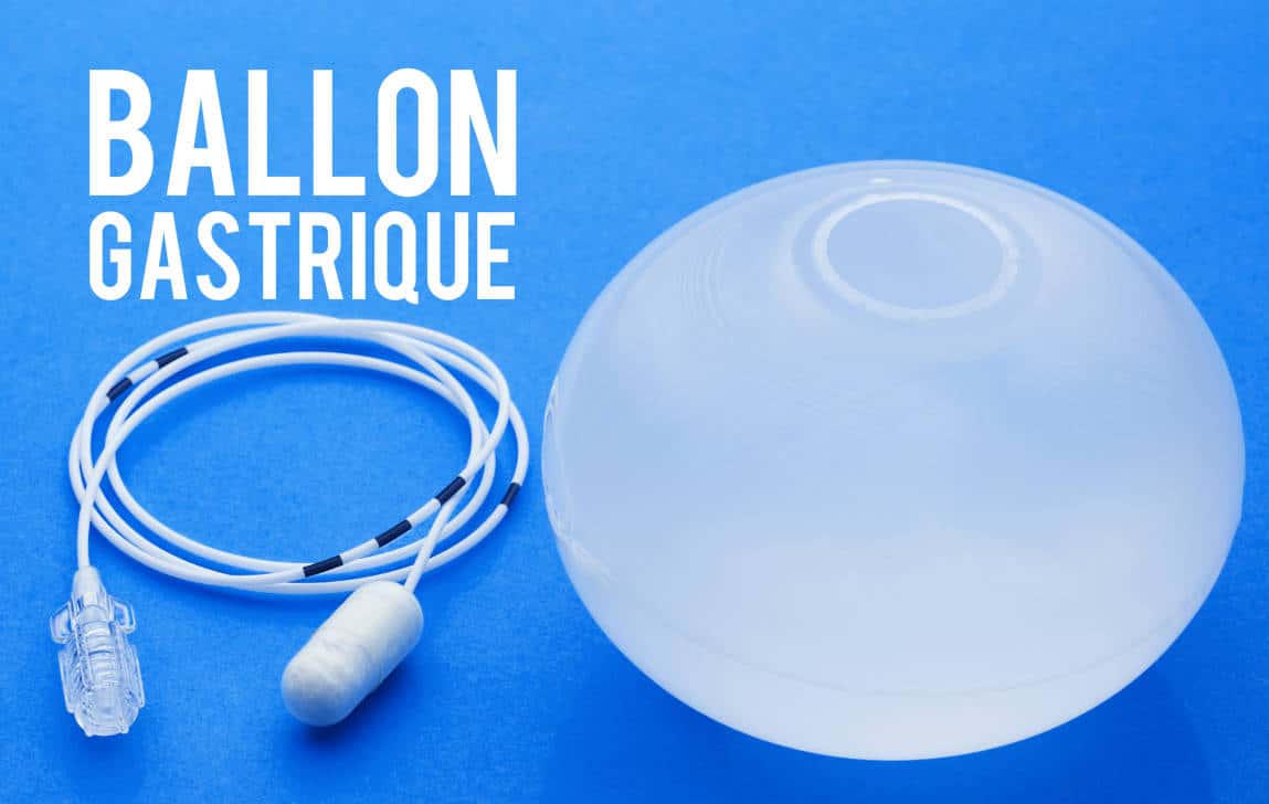 pilule ballon gastrique prix - Blog Clinique Espoir Tunisie